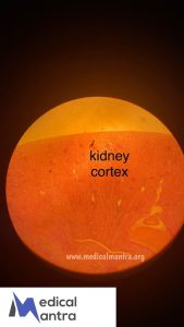 Kidney 20Cortex 20histological 20Specimen 20Urinary 20System 20histology 20medicalmantra