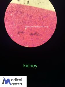 Kidney 20Histological 20Specimens 20Urinary 20tract 20histology 20medicalmantra