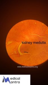 Kidney 20Medulla 20Histological 20Specimens 20Urinary 20System 20histology 20medicalmantra