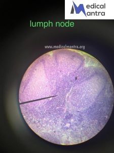 Lymph 20Nodes 20Histological 20Specimens 20Urinary 20System 20histology 20medicalmantra