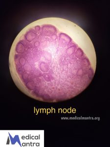 Lymph 20Nodes 20Histological 20Specimens 20Urinary 20tract 20histology 20medicalmantra
