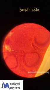 Lymph 20Nodes 20histology 20Specimens 20Urinary 20System 20histology 20medicalmantra