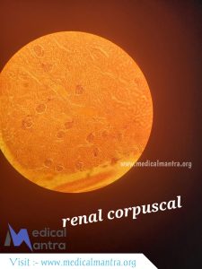 Renal 20Carpuscles 20histological 20Specimen 20Urinary 20tract 20histology 20medicalmantra
