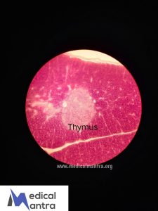 Thymus 20Histological 20Specimens 20Urinary 20System 20histology 20medicalmantra