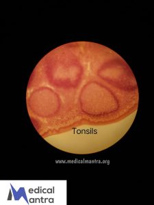 Tonsils 20Histological 20Specimens 20Urinary 20System 20histology 20medicalmantra