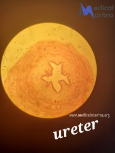 Ureter 20histological 20Specimen 20Urinary 20System 20histology 20medicalmantra