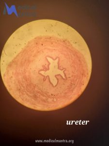 Ureter 20histological 20Specimen 20Urinary 20tract 20histology 20medicalmantra