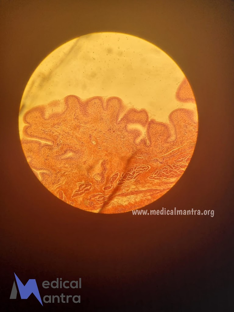 Urinary System histological Specimens , Histology of Urinary Tract , Urinary Bladder Histology 18 Urinary System histological Specimens , Histology of Urinary Tract , Urinary Bladder Histology