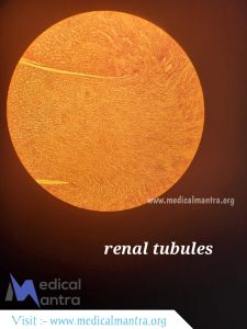 Urinary 20Tubules 20Histological 20Specimen 20Urinary 20tract 20histology 20medicalmantra