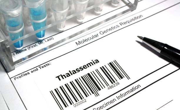 Thalassemia: Types, Symptoms, Causes and Treatment 10 Thalassemia