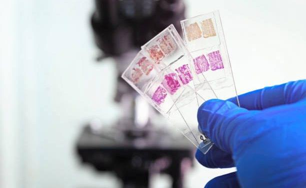 Unlock Tonsils Histology:  Learn the Structure and Composition of Palatine Tonsils, Pharyngeal Tonsils, Lingual Tonsils