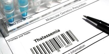 Thalassemia: Types, Symptoms, Causes and Treatment 2 Thalassemia
