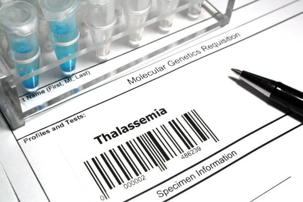 Thalassemia: Types, Symptoms, Causes and Treatment 11 Thalassemia